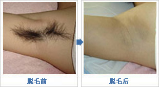 宫颈性不孕 .jpg