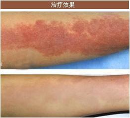 美莱祛内分泌失调好不好